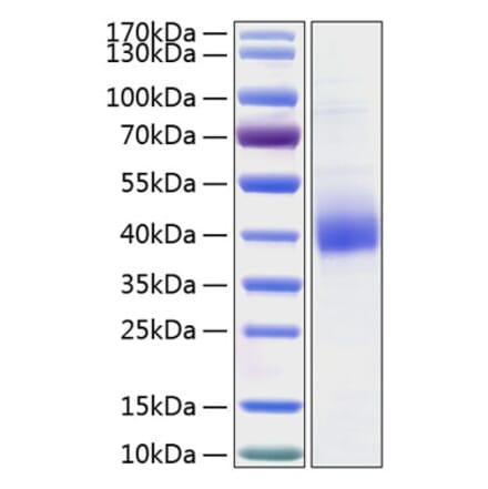 SDS-PAGE - Recombinant Human CLEC10A Protein (C-terminal His Tag) (A330458) - Antibodies.com