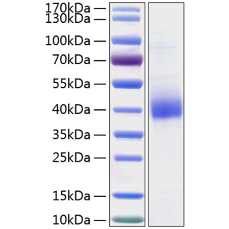 SDS-PAGE - Recombinant Human CLEC10A Protein (C-terminal His Tag) (A330458) - Antibodies.com