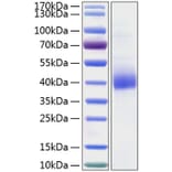 SDS-PAGE - Recombinant Human CLEC10A Protein (C-terminal His Tag) (A330458) - Antibodies.com