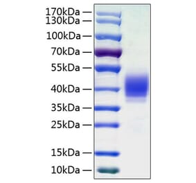 SDS-PAGE - Recombinant Human CLEC12A Protein (C-terminal His Tag) (A330459) - Antibodies.com