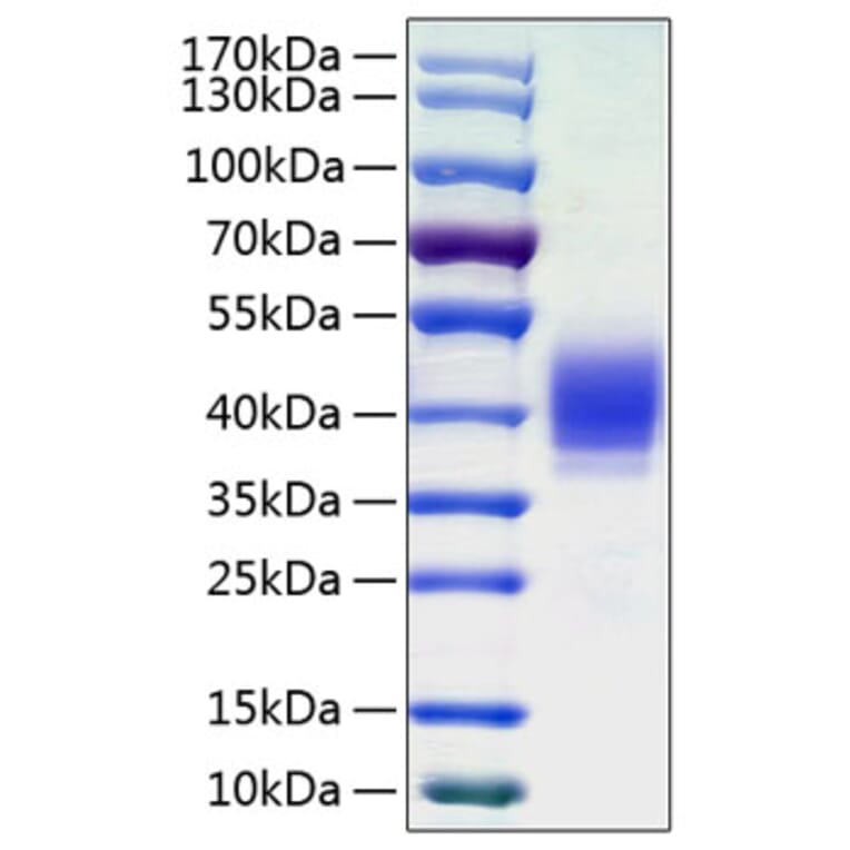SDS-PAGE - Recombinant Human CLEC12A Protein (C-terminal His Tag) (A330459) - Antibodies.com