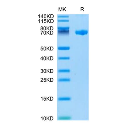 Tris-Bis PAGE - Recombinant Human CLEC2D Protein (Biotin) (N-terminal Human Fc and Avi Tag) (A330460) - Antibodies.com