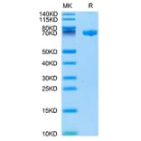 Tris-Bis PAGE - Recombinant Human CLEC2D Protein (Biotin) (N-terminal Human Fc and Avi Tag) (A330460) - Antibodies.com