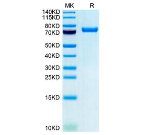 Tris-Bis PAGE - Recombinant Human CLEC2D Protein (N-terminal Human Fc and Avi Tag) (A330461) - Antibodies.com