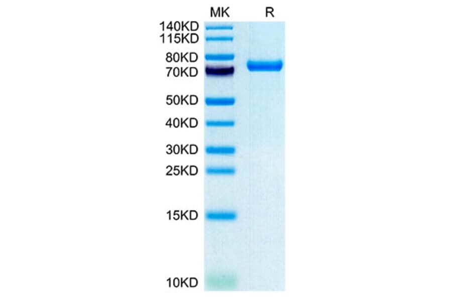 Tris-Bis PAGE - Recombinant Human CLEC2D Protein (N-terminal Human Fc and Avi Tag) (A330461) - Antibodies.com