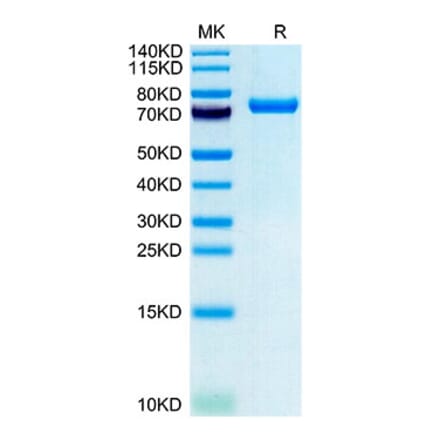 Tris-Bis PAGE - Recombinant Human CLEC2D Protein (N-terminal Human Fc and Avi Tag) (A330461) - Antibodies.com