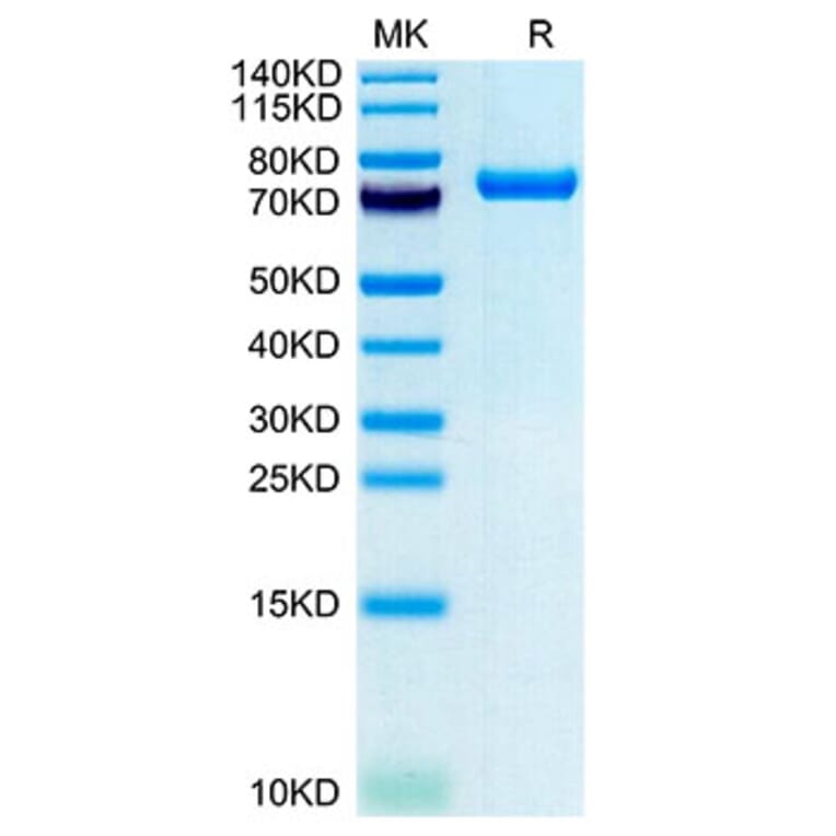 Tris-Bis PAGE - Recombinant Human CLEC2D Protein (N-terminal Human Fc and Avi Tag) (A330461) - Antibodies.com