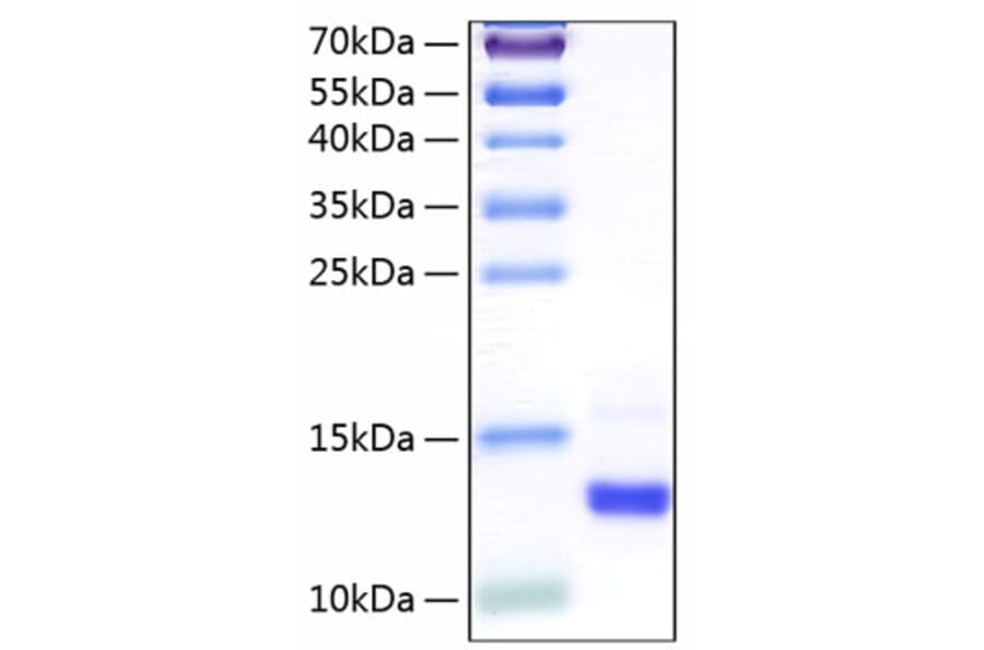 SDS-PAGE - Recombinant Human CLPS Protein (C-terminal His Tag) (A330463) - Antibodies.com