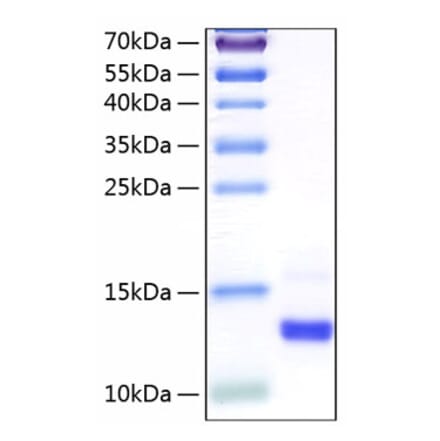 SDS-PAGE - Recombinant Human CLPS Protein (C-terminal His Tag) (A330463) - Antibodies.com