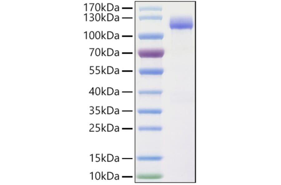 SDS-PAGE - Recombinant Human CLSTN1 Protein (C-terminal His Tag) (A330464) - Antibodies.com