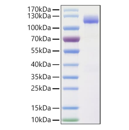 SDS-PAGE - Recombinant Human CLSTN1 Protein (C-terminal His Tag) (A330464) - Antibodies.com