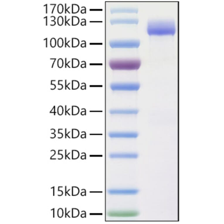 SDS-PAGE - Recombinant Human CLSTN1 Protein (C-terminal His Tag) (A330464) - Antibodies.com