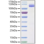 SDS-PAGE - Recombinant Human CLSTN1 Protein (C-terminal His Tag) (A330464) - Antibodies.com