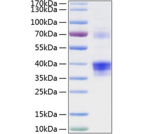 SDS-PAGE - Recombinant Human Clusterin Protein (C-terminal His Tag) (A330465) - Antibodies.com
