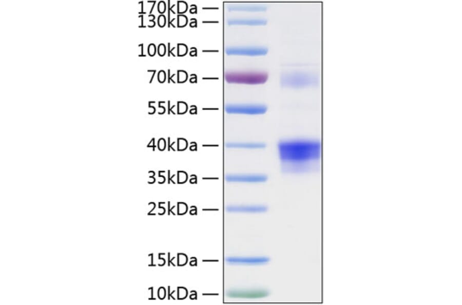 SDS-PAGE - Recombinant Human Clusterin Protein (C-terminal His Tag) (A330465) - Antibodies.com