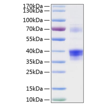 SDS-PAGE - Recombinant Human Clusterin Protein (C-terminal His Tag) (A330465) - Antibodies.com
