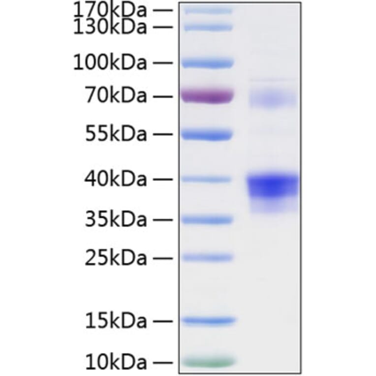 SDS-PAGE - Recombinant Human Clusterin Protein (C-terminal His Tag) (A330465) - Antibodies.com
