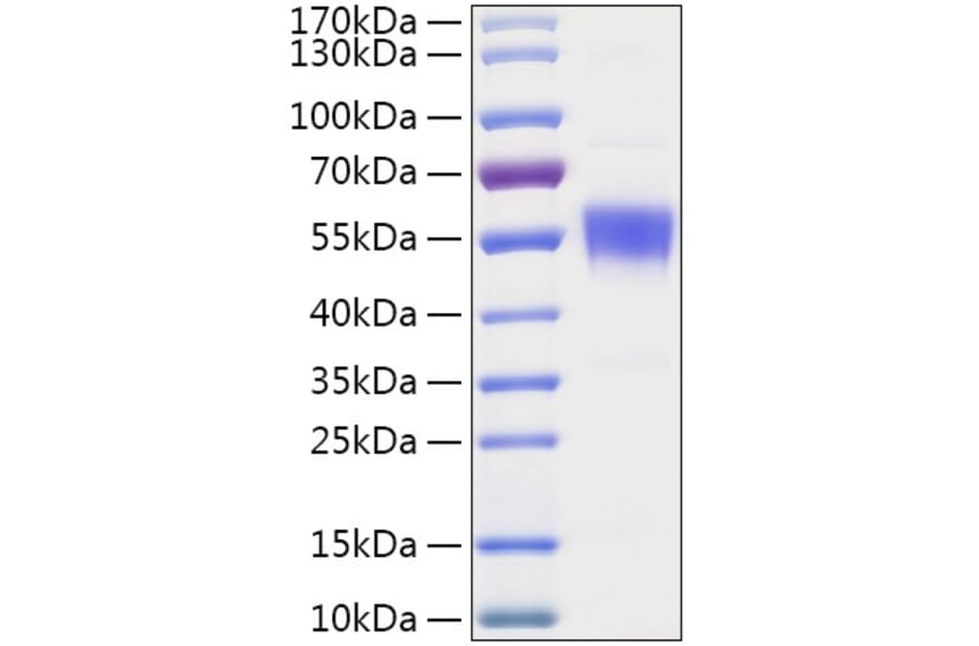 SDS-PAGE - Recombinant Human CNDP2 Protein (C-terminal His Tag) (A330466) - Antibodies.com