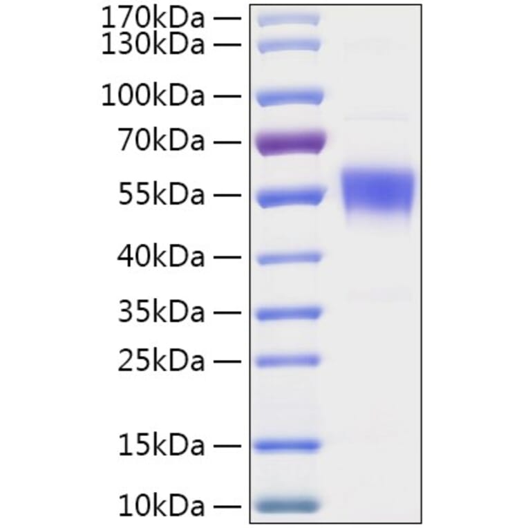 SDS-PAGE - Recombinant Human CNDP2 Protein (C-terminal His Tag) (A330466) - Antibodies.com