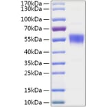 SDS-PAGE - Recombinant Human CNDP2 Protein (C-terminal His Tag) (A330466) - Antibodies.com