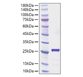 SDS-PAGE - Recombinant Rat CNTF Protein (C-terminal His Tag) (A330467) - Antibodies.com