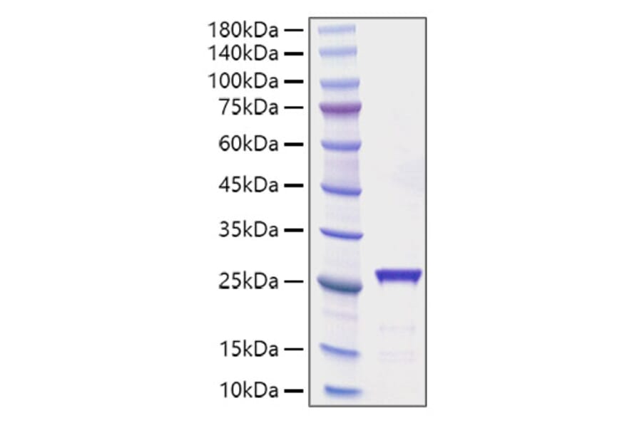 SDS-PAGE - Recombinant Rat CNTF Protein (C-terminal His Tag) (A330467) - Antibodies.com