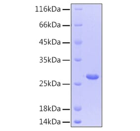 SDS-PAGE - Recombinant Human CNTF Protein (C-terminal His Tag) (A330468) - Antibodies.com