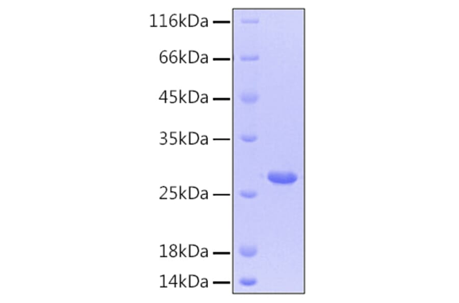 SDS-PAGE - Recombinant Human CNTF Protein (C-terminal His Tag) (A330468) - Antibodies.com