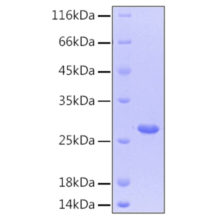 SDS-PAGE - Recombinant Human CNTF Protein (C-terminal His Tag) (A330468) - Antibodies.com