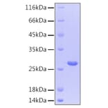 SDS-PAGE - Recombinant Human CNTF Protein (C-terminal His Tag) (A330468) - Antibodies.com