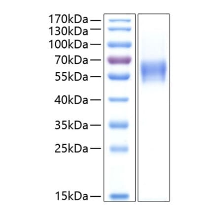 SDS-PAGE - Recombinant Human CNTFR Protein (C-terminal His Tag) (A330469) - Antibodies.com