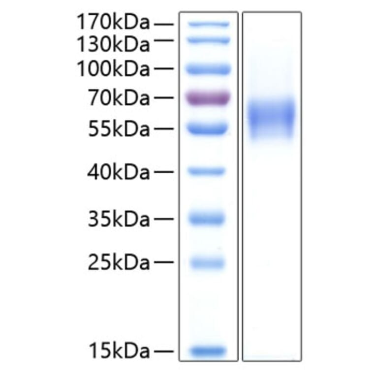 SDS-PAGE - Recombinant Human CNTFR Protein (C-terminal His Tag) (A330469) - Antibodies.com