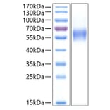 SDS-PAGE - Recombinant Human CNTFR Protein (C-terminal His Tag) (A330469) - Antibodies.com
