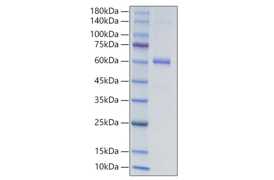 SDS-PAGE - Recombinant Human COL18A1 Protein (N-terminal Human Fc and His Tag) (A330470) - Antibodies.com