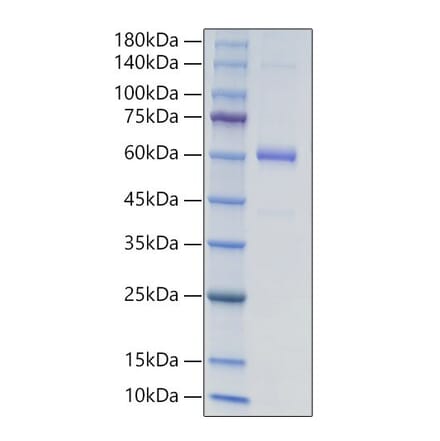 SDS-PAGE - Recombinant Human COL18A1 Protein (N-terminal Human Fc and His Tag) (A330470) - Antibodies.com