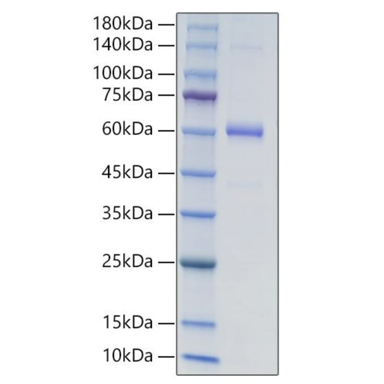 SDS-PAGE - Recombinant Human COL18A1 Protein (N-terminal Human Fc and His Tag) (A330470) - Antibodies.com