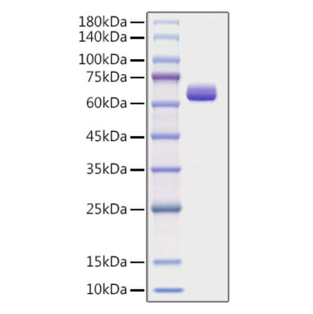 SDS-PAGE - Recombinant Human COL1A2 Protein (C-terminal Human Fc Tag) (A330471) - Antibodies.com