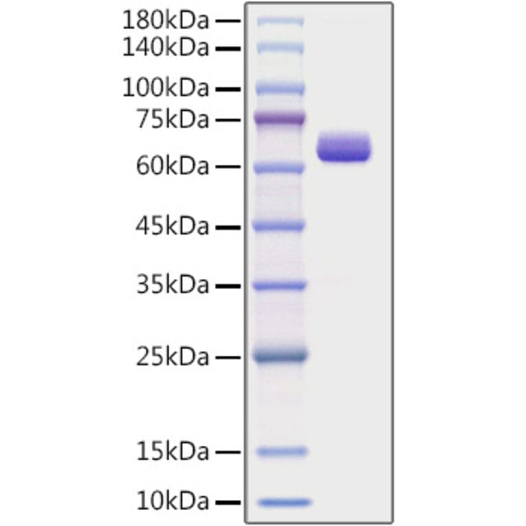 SDS-PAGE - Recombinant Human COL1A2 Protein (C-terminal Human Fc Tag) (A330471) - Antibodies.com