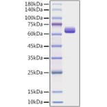 SDS-PAGE - Recombinant Human COL1A2 Protein (C-terminal Human Fc Tag) (A330471) - Antibodies.com