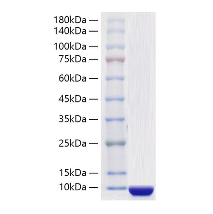 SDS-PAGE - Recombinant Human COL6A3 Protein (A330472) - Antibodies.com