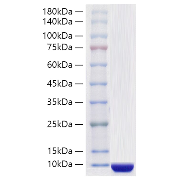 SDS-PAGE - Recombinant Human COL6A3 Protein (A330472) - Antibodies.com