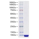 SDS-PAGE - Recombinant Human COL6A3 Protein (A330472) - Antibodies.com