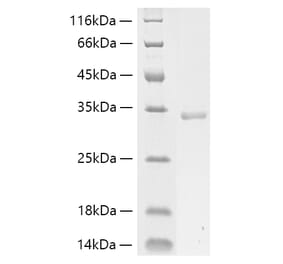SDS-PAGE - Recombinant Human Collagen I Protein (C-terminal His Tag) (A330473) - Antibodies.com