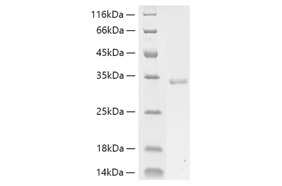 SDS-PAGE - Recombinant Human Collagen I Protein (C-terminal His Tag) (A330473) - Antibodies.com