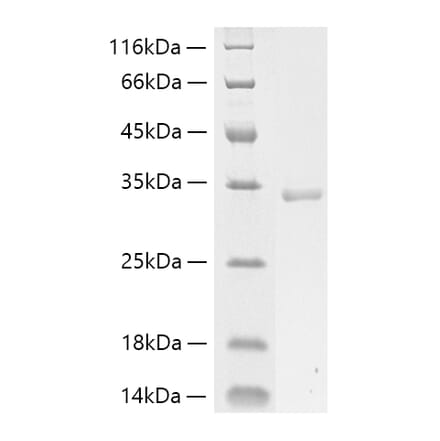 SDS-PAGE - Recombinant Human Collagen I Protein (C-terminal His Tag) (A330473) - Antibodies.com