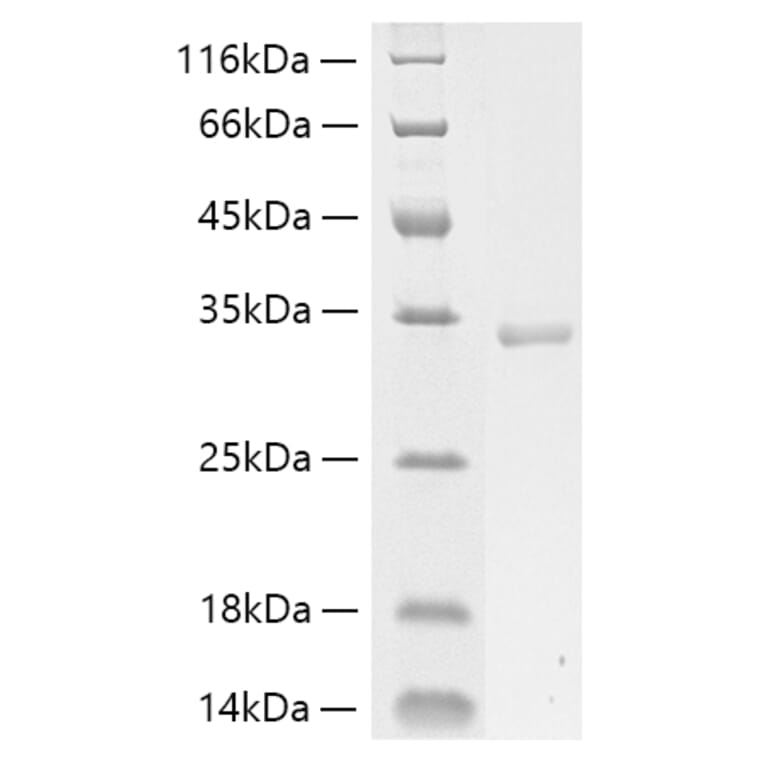 SDS-PAGE - Recombinant Human Collagen I Protein (C-terminal His Tag) (A330473) - Antibodies.com