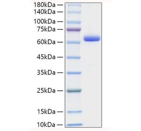 SDS-PAGE - Recombinant Human Collagen I Protein (C-terminal Human Fc Tag) (A330474) - Antibodies.com