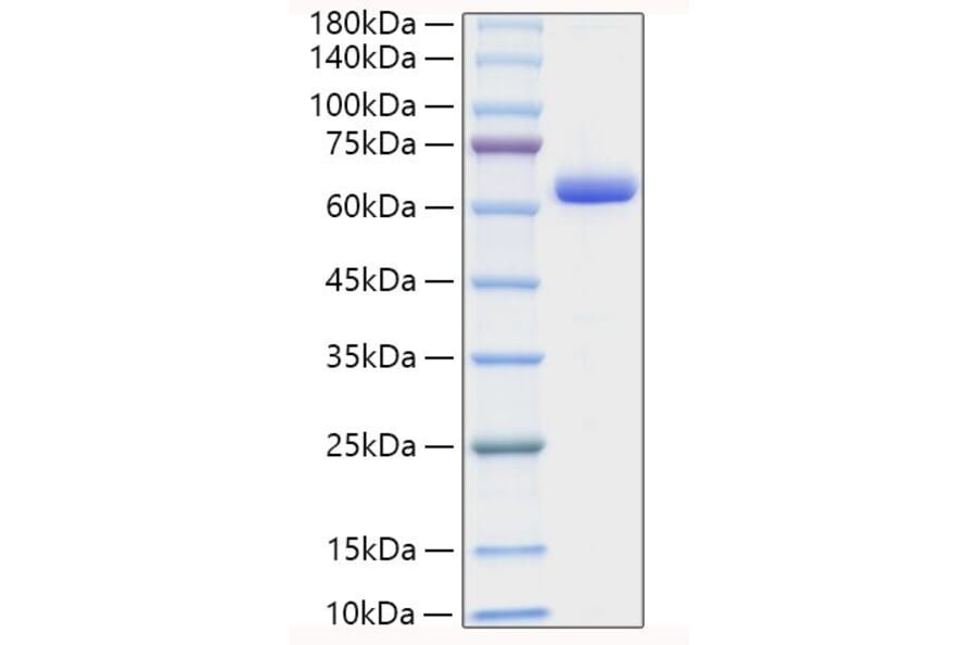SDS-PAGE - Recombinant Human Collagen I Protein (C-terminal Human Fc Tag) (A330474) - Antibodies.com