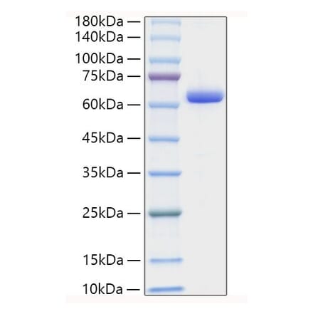 SDS-PAGE - Recombinant Human Collagen I Protein (C-terminal Human Fc Tag) (A330474) - Antibodies.com