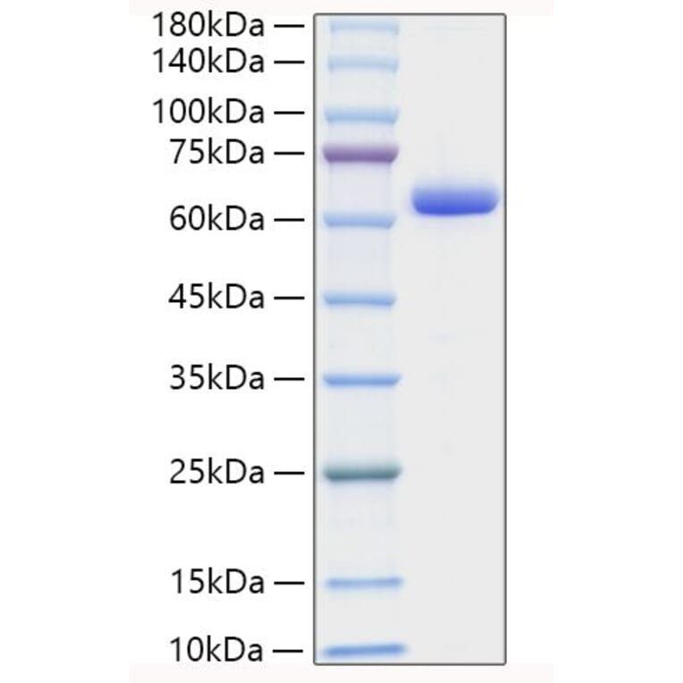 SDS-PAGE - Recombinant Human Collagen I Protein (C-terminal Human Fc Tag) (A330474) - Antibodies.com